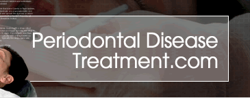 Periodontal Disease Treatment